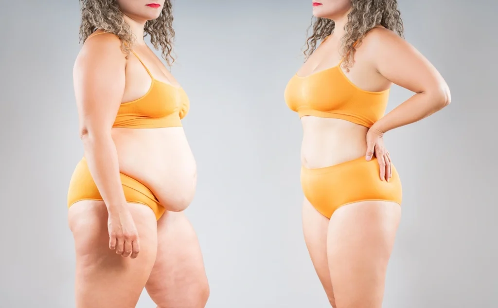 Semaglutide for weight loss by Anti-Aging & Laser Institute in Providence, RI
