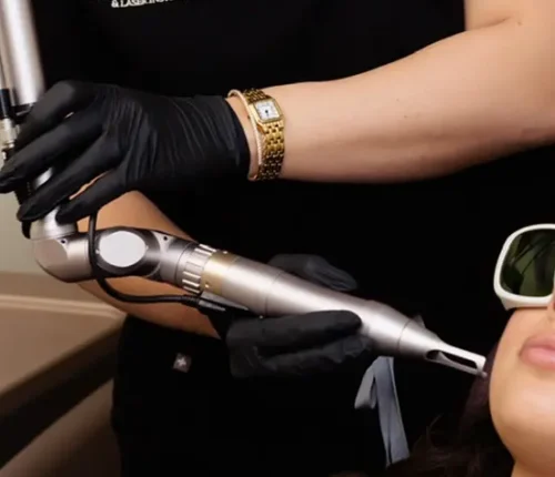 Cosmetic procedure being performed on a woman's face using a skincare device.