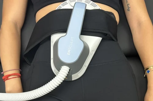 Body contouring device on a woman’s abdomen during a cosmetic treatment.