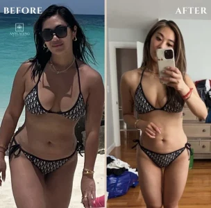 Before and after weight loss transformation of a woman in a bikini.